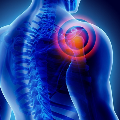 blue graphic of human anatomy with shoulder being highlighted 