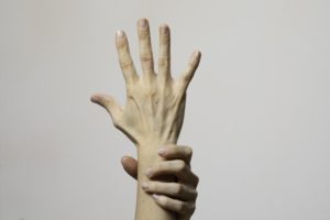 person with Carpal Tunnel Syndrome stretching fingers